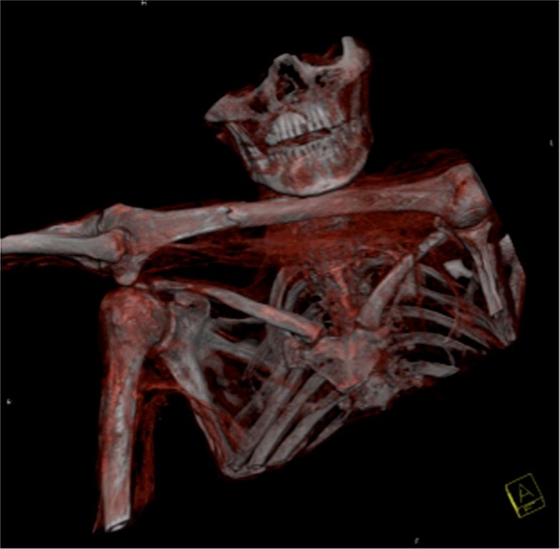 Ötzi: presentati nuovi risultati delle ricerche sulla mummia