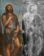 radiografia tiziano